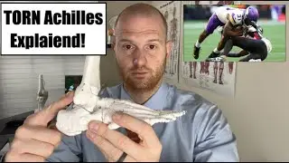 Cam Akers Injury Update!  Cam Akers Achilles Injury Explained!