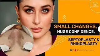 Wide Nose Rhinoplasty Surgery in Delhi | Nose Surgery Before and After| Dr Monisha Kapoor Aesthetics