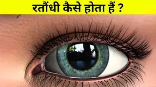 रतौंधी कैसे होता हैं ? Night blindness Science