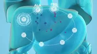 Pathophysiology of Acute Hepatic Porphyria (AHP)