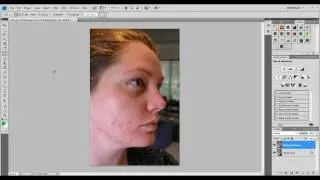 CS4 photoshop tutorial - Removing Acne