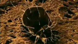 The Unknown Micro World : Dust Mites