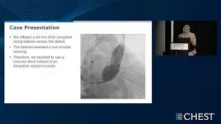 Interventions in Cardiovascular Disease