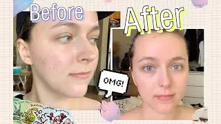 I used a sheet mask everyday for one week !