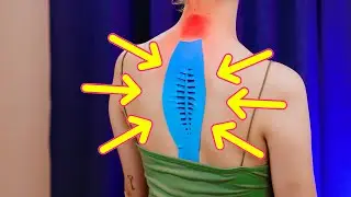 Kinesiology Tape Placement Revealed! 🔍