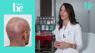 Tips after a hair transplant. Aftercare | Be Clinics