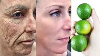 Cómo Usar El Limón Para Eliminar Las Arrugas Y Desvanecer Las Manchas Oscuras En La Cara