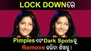 How To Remove [Black Spot And Pimples] From Face In Photoshop| remove black spots Photoshop in odia