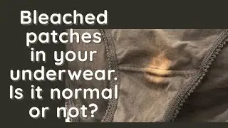 Why your vagina leaves ‘bleached’ patches in your underwear. #women