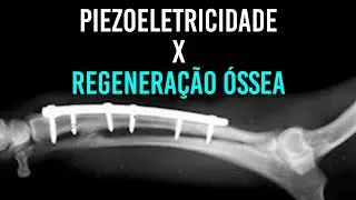 Entenda a regeneração óssea das fraturas