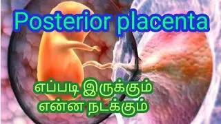 posterior placenta means in Tamil || placenta types|| முன்புறநஞ்சுக்கொடி