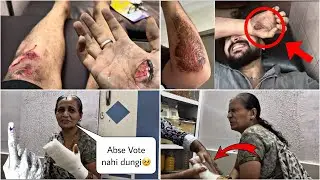 VOTE DENA PADA MUMMY KO BHAARI!😭| I MET WITH AN DEADLY ACCIDENT🪦