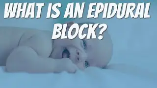 WHAT IS AN EPIDURAL BLOCK?