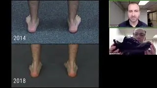 The Egoscue Method // Orthotics - TMJ  - 