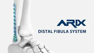 [ARIX OS] ARIX Distal Fibula Surgical Guide