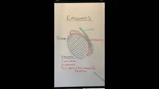 Epididymitis causes testicular swelling and pain