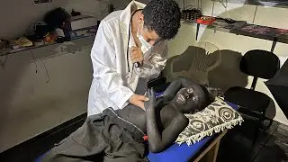 MÉDICO DISSE QUE ESSE MENINO VIRA LOBISOMEM