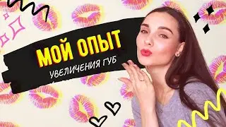 УВЕЛИЧЕНИЕ ГУБ мой опыт ГИАЛУРОНКА УКОЛЫ КРАСОТЫ БОЛЬНО ЛИ КОЛОТЬ ГУБЫ последствия увеличения губ