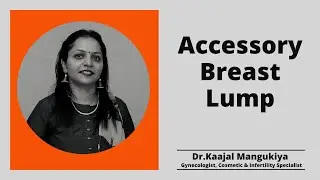 Accessory Breast Lump | Dr.Kaajal Mangukiya