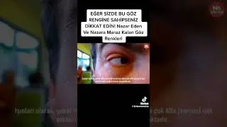 Nazar. göz dəyməsi.+994559031881 Vüsal Merdinli.#islam #türkiye #azerbaycan #istanbul #kuran