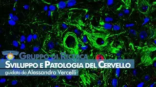 NICO - Sviluppo e Patologia del Cervello