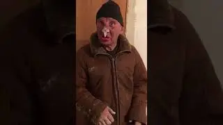 Мужик отморозил себе нос и руки