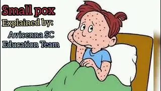 A short video on Small pox by Avicenna Students | Avicenna International Medical University