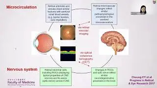 Using Deep Learning for Detection of Alzheimer's Disease Based on Retinal Images (10 Oct 2023)