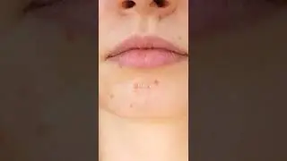 Где лечить рак? 