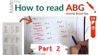 Arterial blood gas test | ABG | Modified Allen's Test | How to take an ABG sample | Part 2