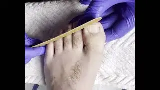 Sports Pedicure For Men (Right Foot)