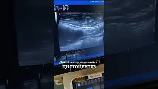 Цистоцентез // Как берут анализ мочи у собаки на УЗИ