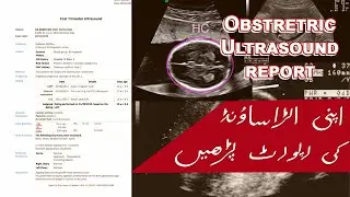 Obstetric Ultrasound Report (Urdu/Hindi)