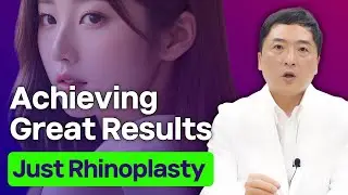 Achieving Great Results with Just Rhinoplasty: Successful Tip Rhinoplasty Cases Before and After