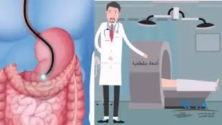 التنظير بالأشعة الصوتية ماهو؟