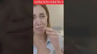 बिना दिल के ये बच्चा जिंदा कैसे हैं 🤔#shorts #viral #india #facts