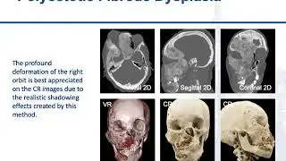 Cinematic Rendering – Clinical Applications of 3D Imaging