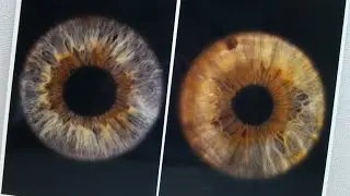 IRIS Fotografie / Fotografie der Iris