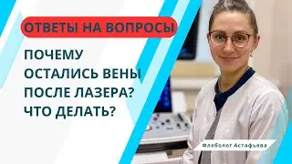ПОЧЕМУ ОСТАЛИСЬ ВЕНЫ ПОСЛЕ ЛАЗЕРА? ЧТО ДЕЛАТЬ?