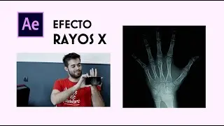 X RAY after effects