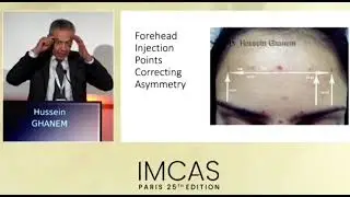 Forehead Botox lecture at IMCAS 2024,  Paris. Professor Hussein Ghanem