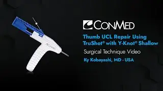 Thumb UCL Repair Using TruShot® with Y-Knot® Shallow - Ky Kobayashi, MD - Surgical Technique