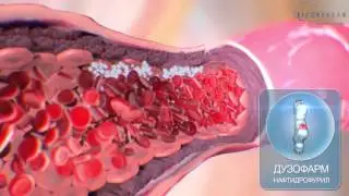 Anti-ischemic drug 