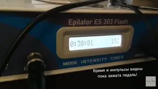 Подсчёт минут и импульсов на Биомаке! Функция о которой знают не все!