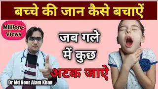 बच्चे के गले में कुछ अटक जाए तो क्या करें || How to save a choking child || Dr Md Noor Alam