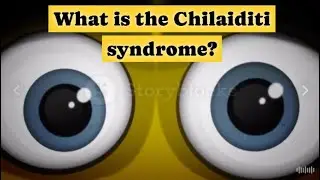 What is the Chilaiditi syndrome?