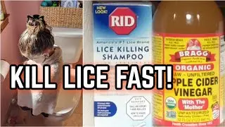 HOW TO GET RID OF LICE FAST!! 😲🦟 AND KEEP IT FROM COMING BACK!!