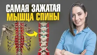 Из-за ЭТОЙ мышцы у 99% людей БОЛИТ СПИНА и ПОЯСНИЦА | Делай эти 5 упражнений
