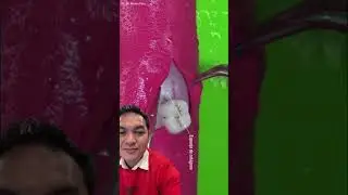 Belom lagi nanti pas operasi bisa foto" sama Dokternya.. pkoknya se asyik ituu deh