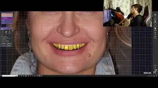 ГИПСОВКА В EXOCAD ПО КТ, МОДЕЛИРОВКА ОККЛЮЗИОННОЙ ШИНЫ, ФУНКЦИОНАЛЬНЫЙ WAXUP видео уроки